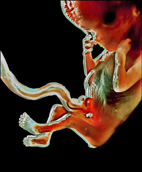 fetus, unborn baby
